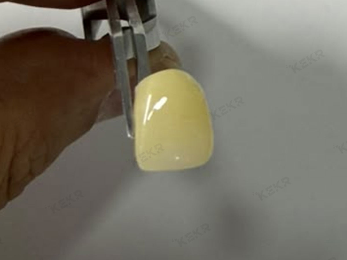 3D FLASH zirconia used in a dental lab workflow