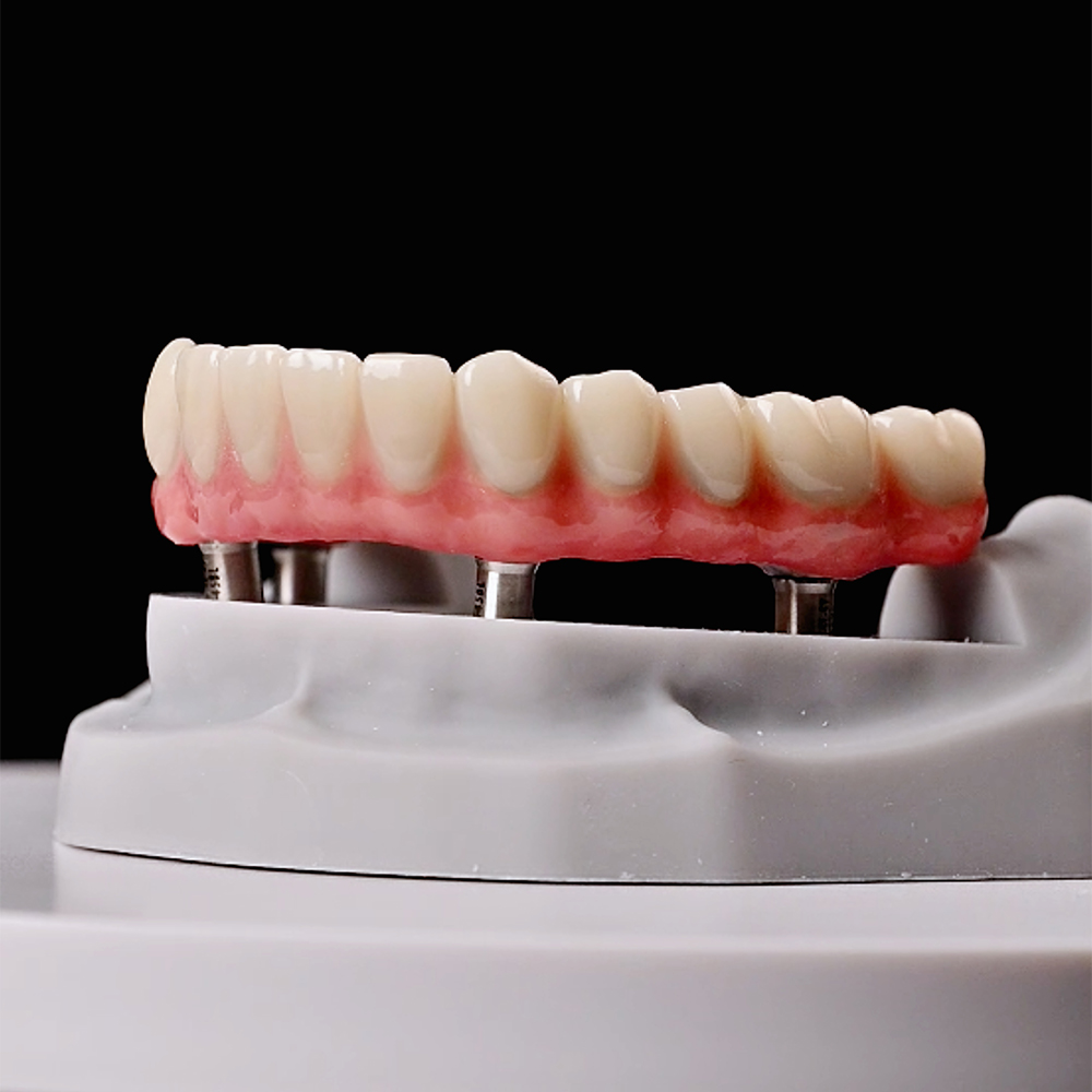 Dental Light-Cure Composite Resin