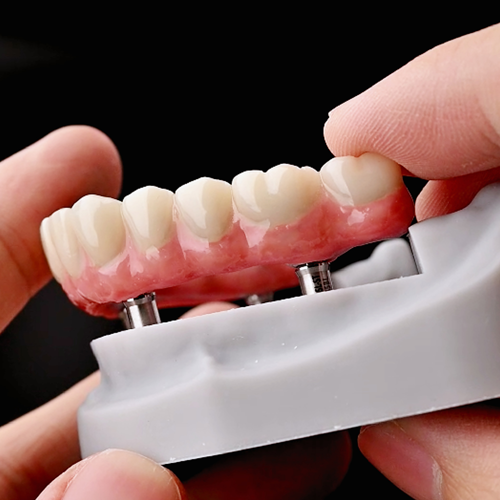 Dental Light-Cure Composite Resin